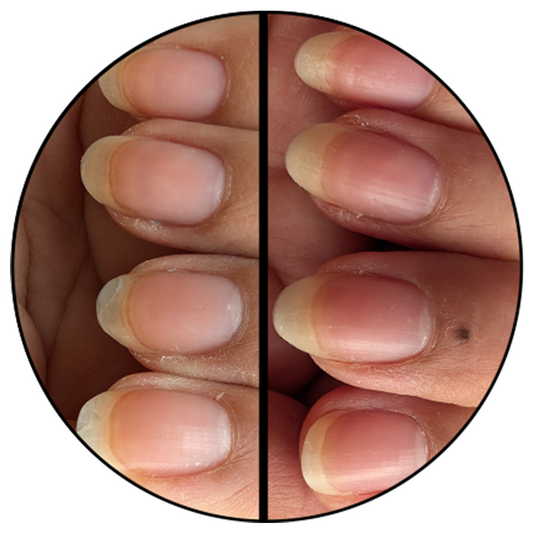 Close-up of natural nails before and after using Advanced Nail Strengthener showing stronger, healthier nail growth results