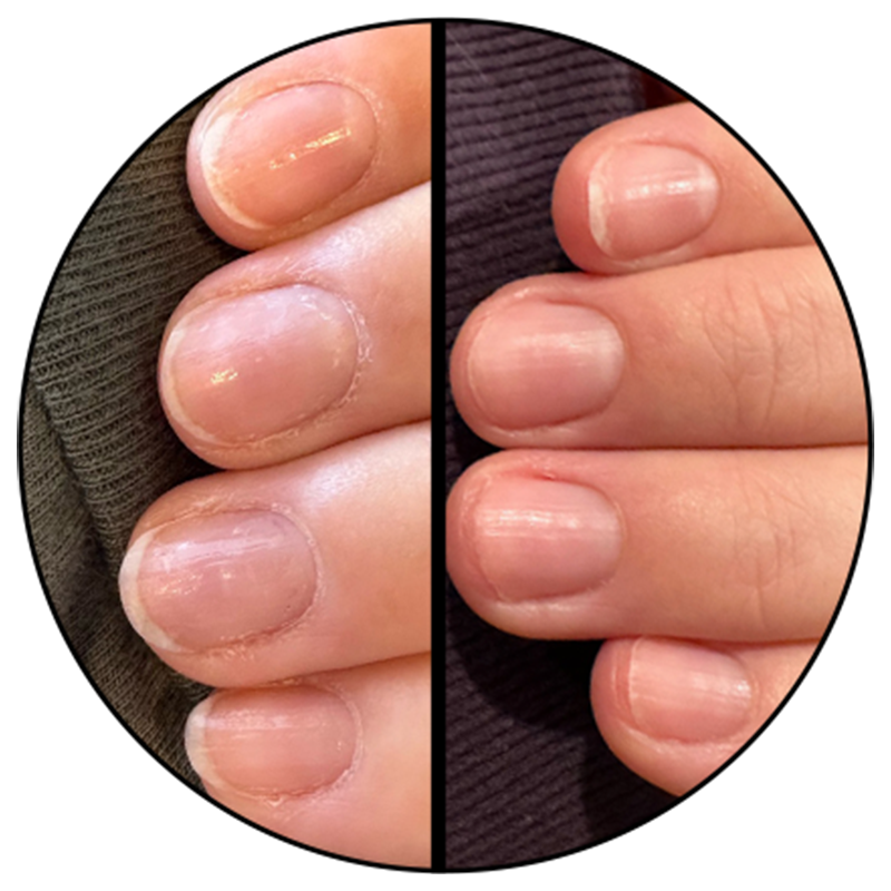 Comparison of nails before and after using Cuticle Oil showing improved hydration and smoother cuticles for nail care.